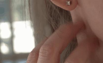 爱长痘的人一直长痘,爱长痘痘的皮肤