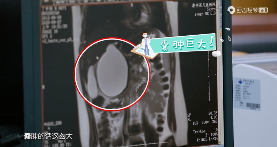 暑假扎堆割包皮,暑假组团割包皮