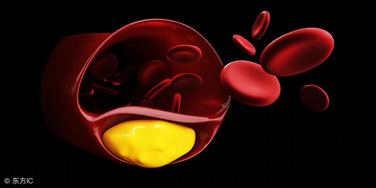 血压160要吃药吗没有什么症状,血压16085需要吃药吗