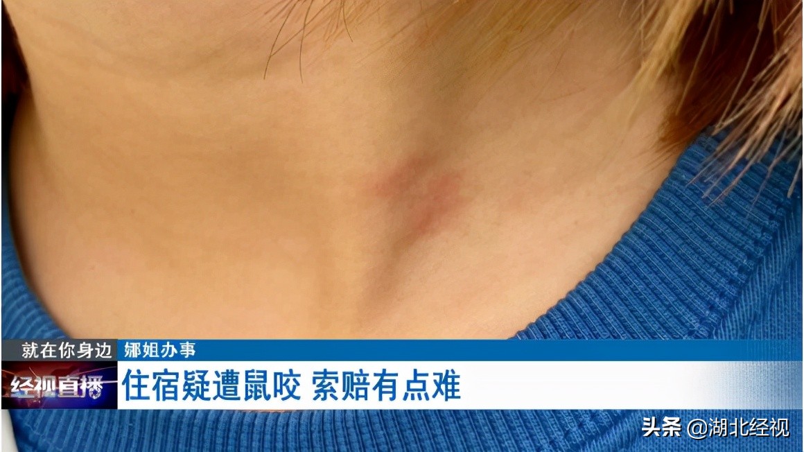 住酒店被小虫咬了一个小洞,住民宿被老鼠咬了