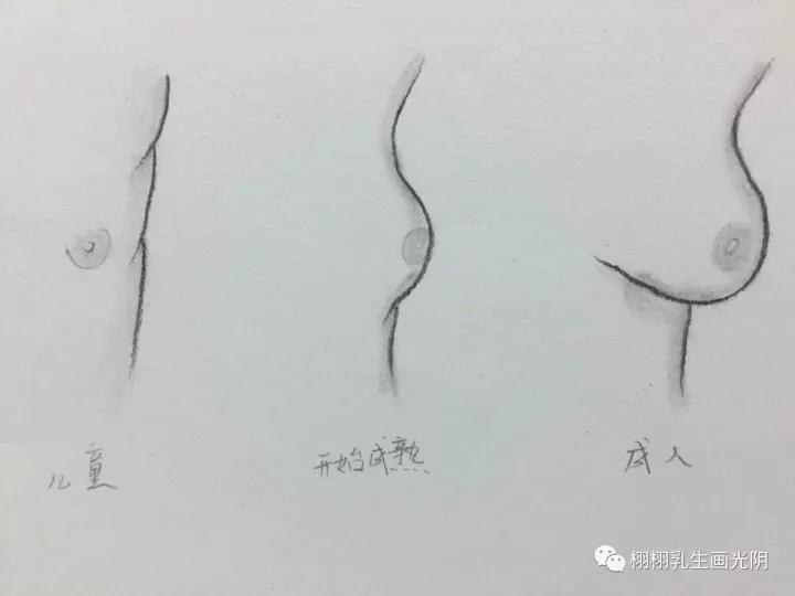 乳房发育早熟怎么治疗,乳房早熟有什么方法治疗