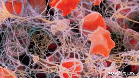 肿瘤标志物检测的常见问题,6种肿瘤标志物