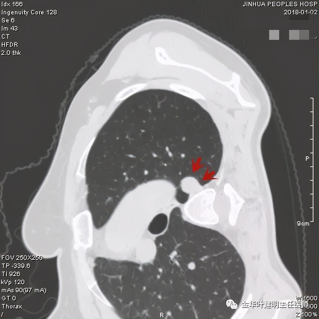 误诊报告图片,误诊案例及案例分析