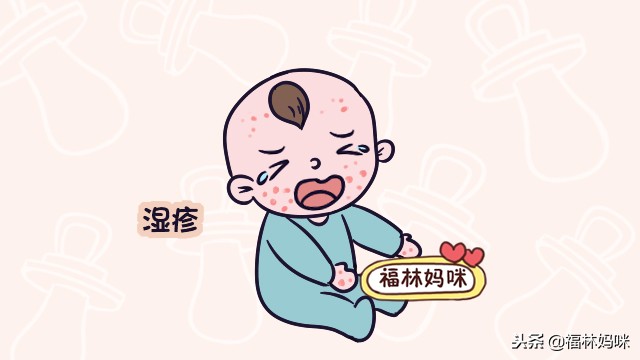 还在试各种方法去胎毒?乳痂、湿疹、黄疸,其实是这么回事儿!