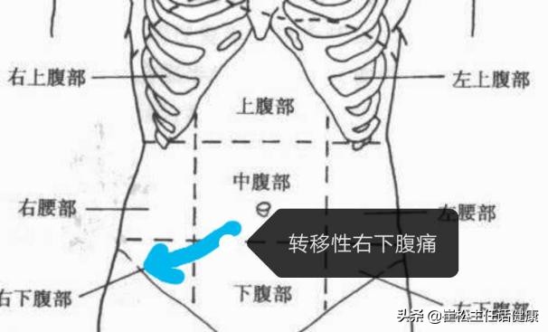 不想去医院第三弹！腹部不适的自我诊察