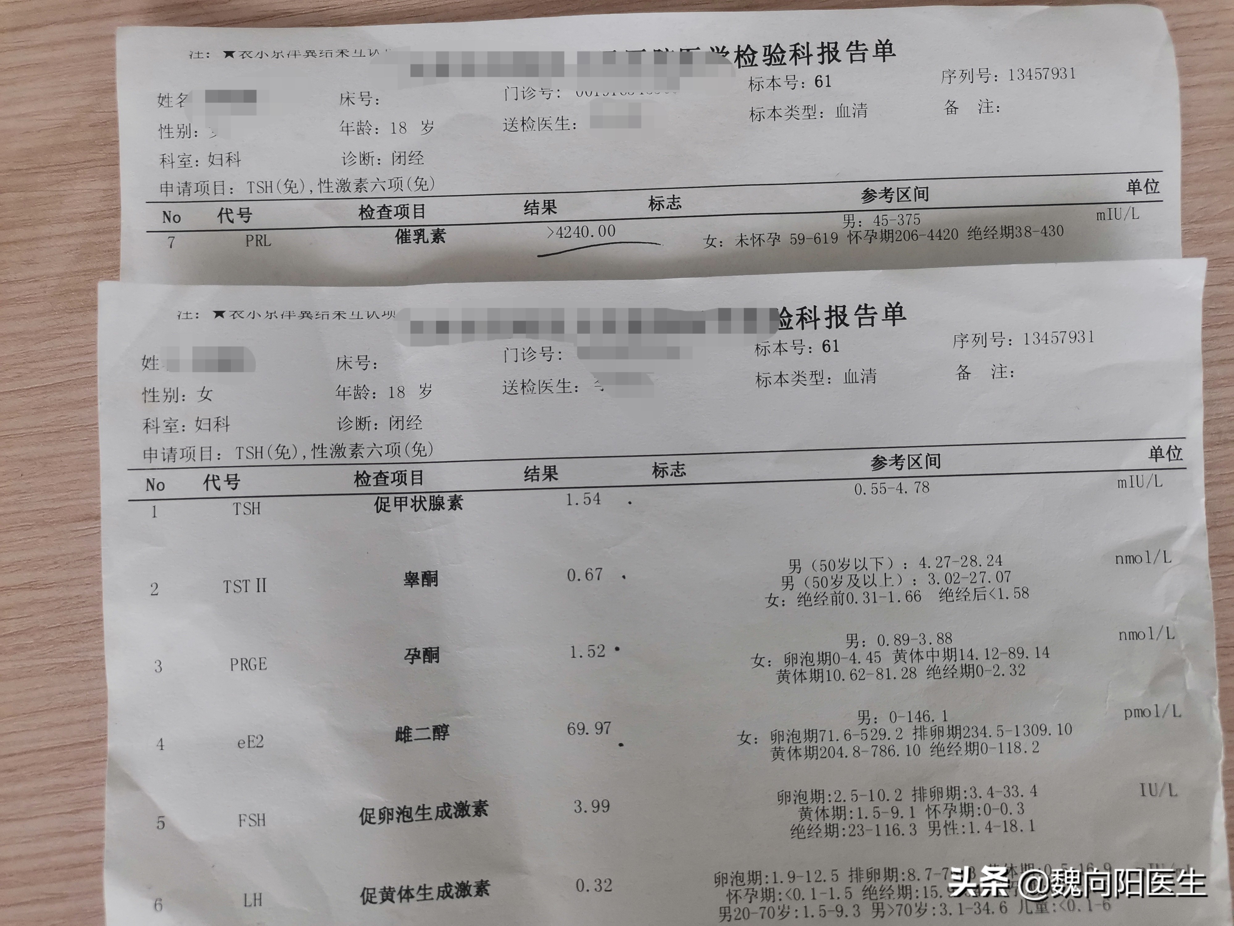 垂体瘤10岁女孩,小孩得了垂体瘤一定要手术吗