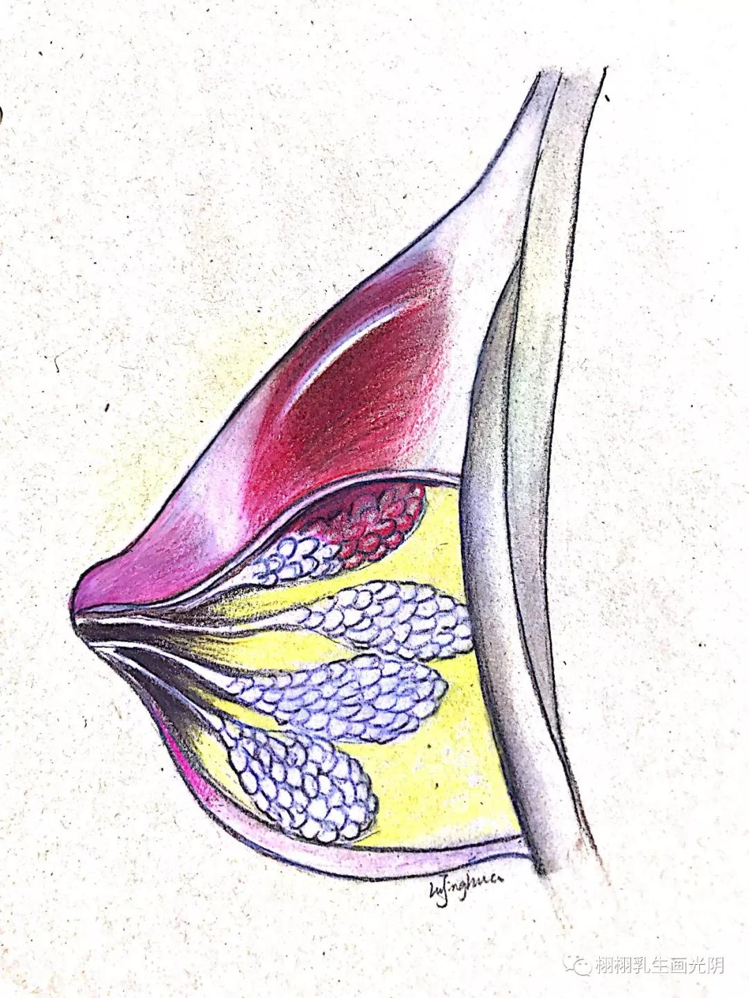 乳腺炎的6大现象,怎么确定是真正的乳腺炎