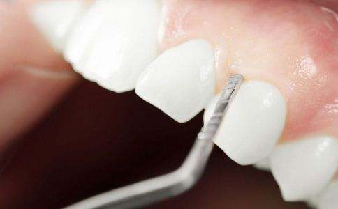 牙龈红肿牙齿有点松动了怎么办呀,牙龈松动是牙龈炎还是牙周炎