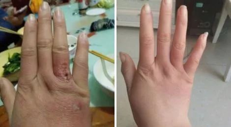 冬天脚后跟干裂用什么润脚霜,润足脚后跟干裂修复霜