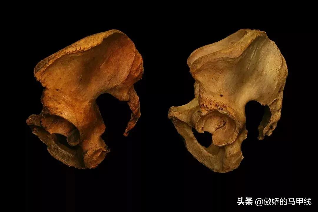 深蹲屁股眨眼如何改善,深蹲屁股眨眼正确吗