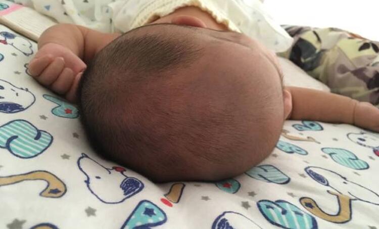 宝宝睡偏头了该如何纠正,如何防止宝宝睡偏头及补救方法