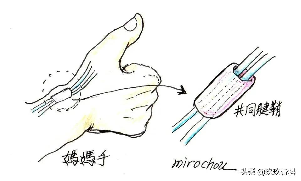 做家务手腕突然酸痛怎么缓解,手腕疼做运动时怎么保护