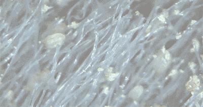 床单不洗螨虫成千上万,床单30天不洗竟螨虫成堆