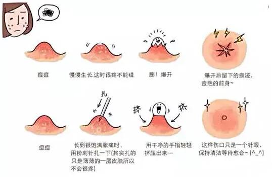 来大姨妈脸上会长痘痘怎么回事,来例假脸上起痘痘是怎么回事啊