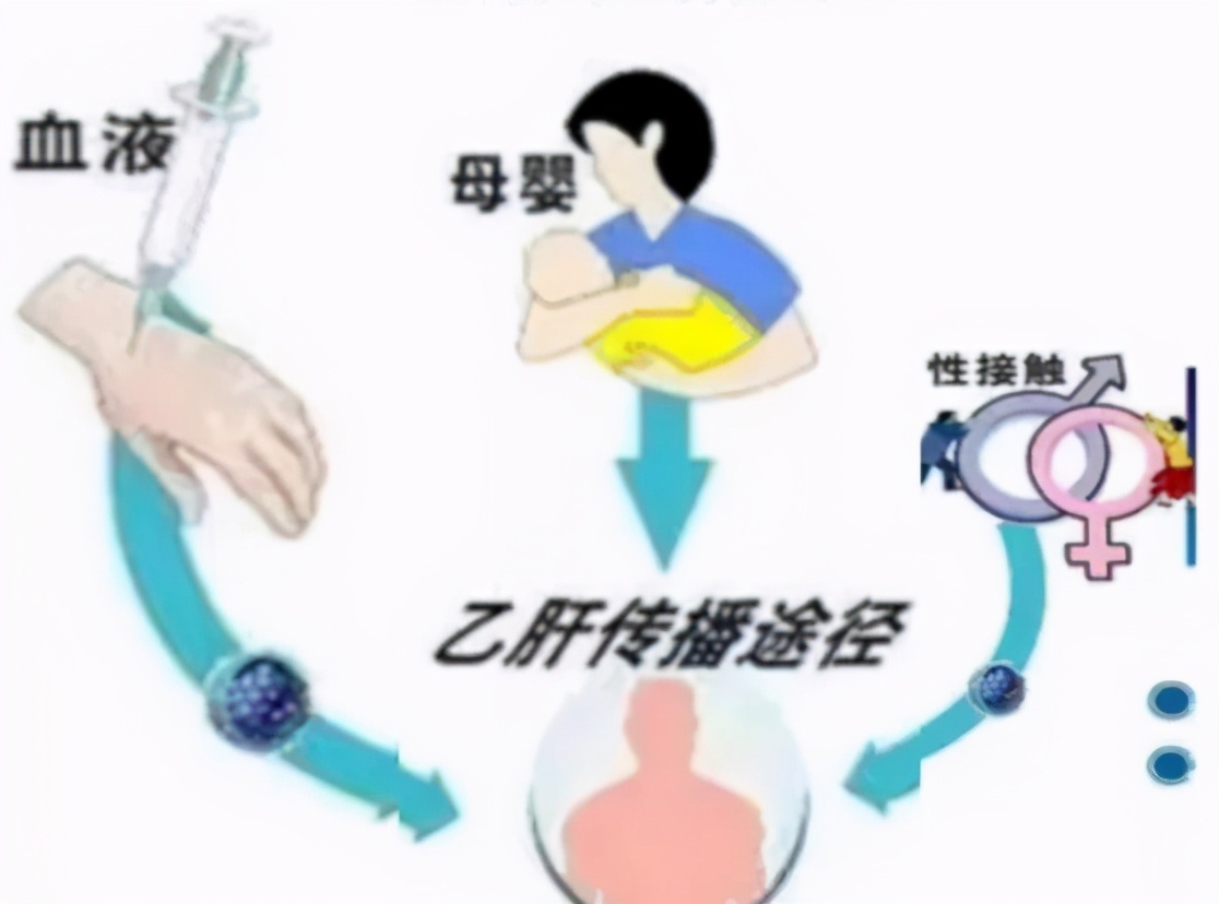 给乙肝患者一个忠告,给乙肝患者的三个忠告