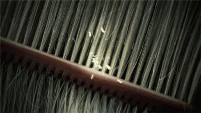 去屑的小技巧,去屑真正有效的方法