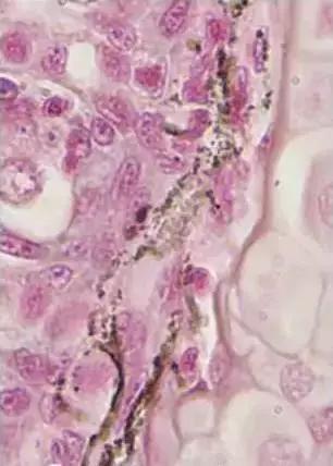 水产鱼鳃虫怎么治疗最好,鱼鳃霉病图片