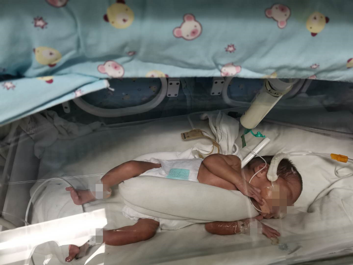 全国罕见三胞胎姐妹相隔两天出生,罕见三胞胎婴儿