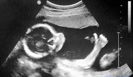 卧龙区第一医院体检,健康科普测一测