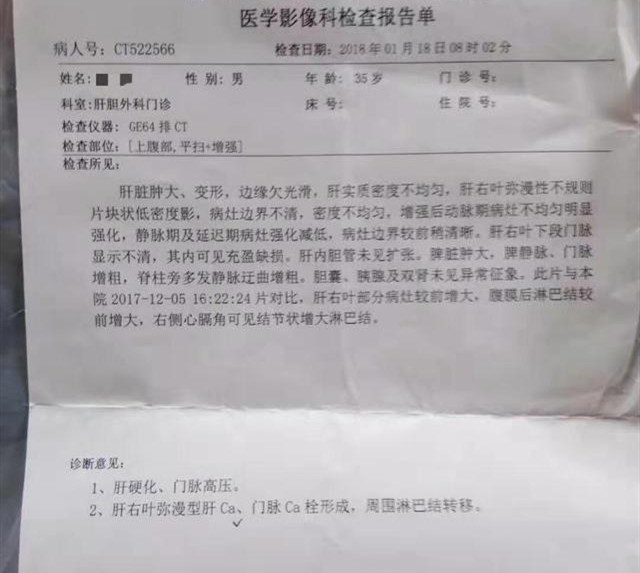 癌晚期生存期,肝癌晚期癌栓怎么治