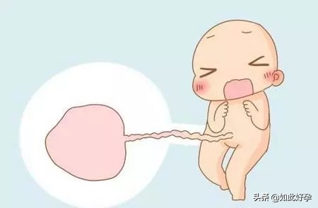 孕晚期要警惕早产的四大征兆,孕妇孕晚期胎盘低注意事项是什么