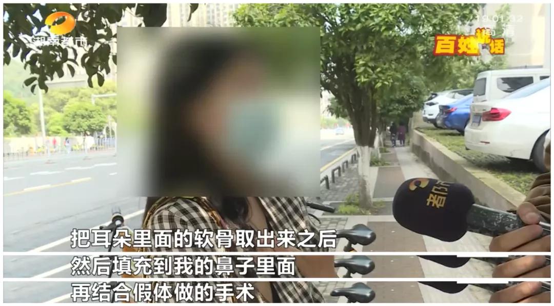 隆鼻微整形需谨慎,隆鼻整容需谨慎