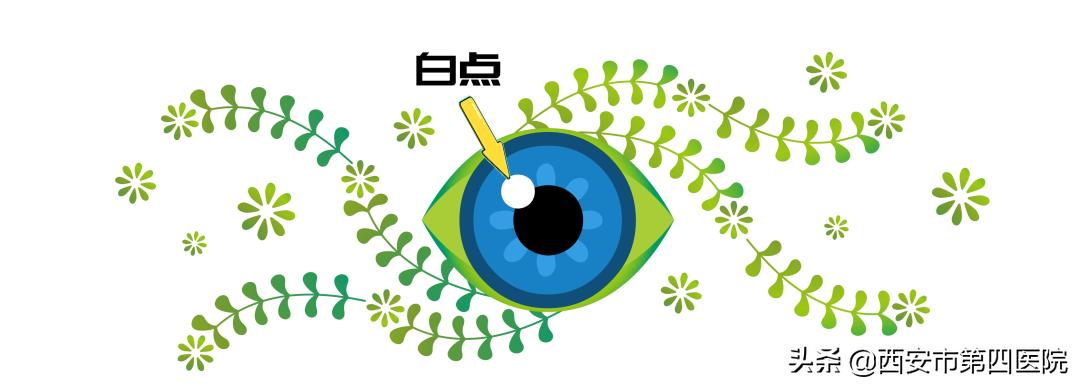 【医学科普】警惕！20天宝宝，眼珠旁有白点，可能危及视力！