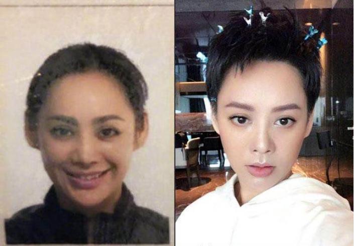 美容针美容的误区,为美而整容最后付出的代价