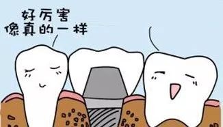 牙齿那些事儿调查表,牙齿科普小知识种植牙
