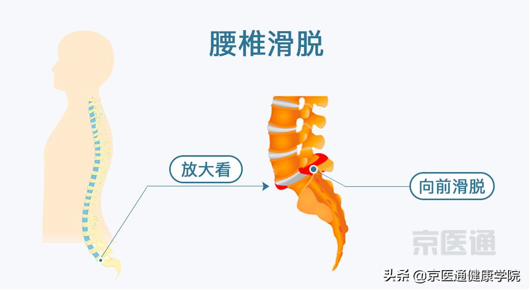 腰痛骨科怎么治疗,腰痛腿痛有什么特效药