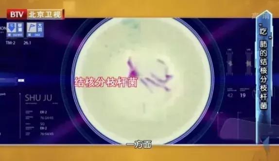 身上长了很多小疣是hpv感染了吗,身上有肿块是否是hpv造成