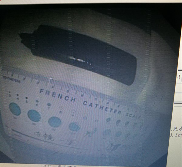 人民医院林涛医生,林涛大夫