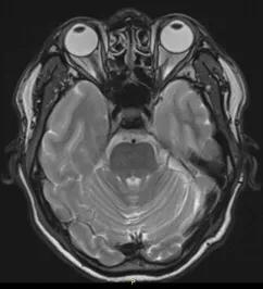 讲解医学影像的书,医学影像学几年