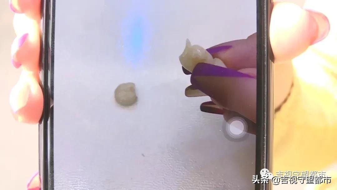 换了烤瓷牙异物感特别强,烤瓷牙多年后感觉吸冷空气牙酥酥