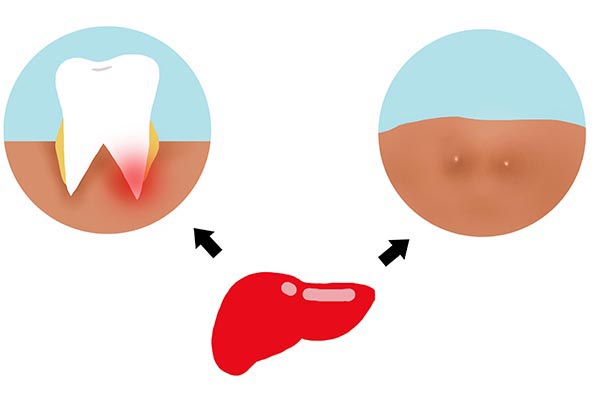 乙肝尿酸偏高如何补充蛋白质,乙肝患者怎么补充营养