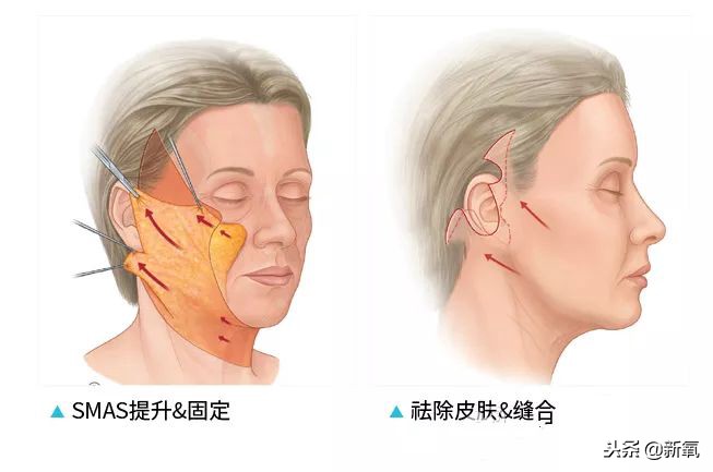 辛芷蕾是苦相女生吗,辛芷蕾气质怎么养成