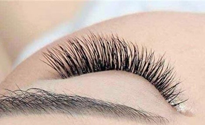 女子求美嫁接睫毛引发双眼肿痒