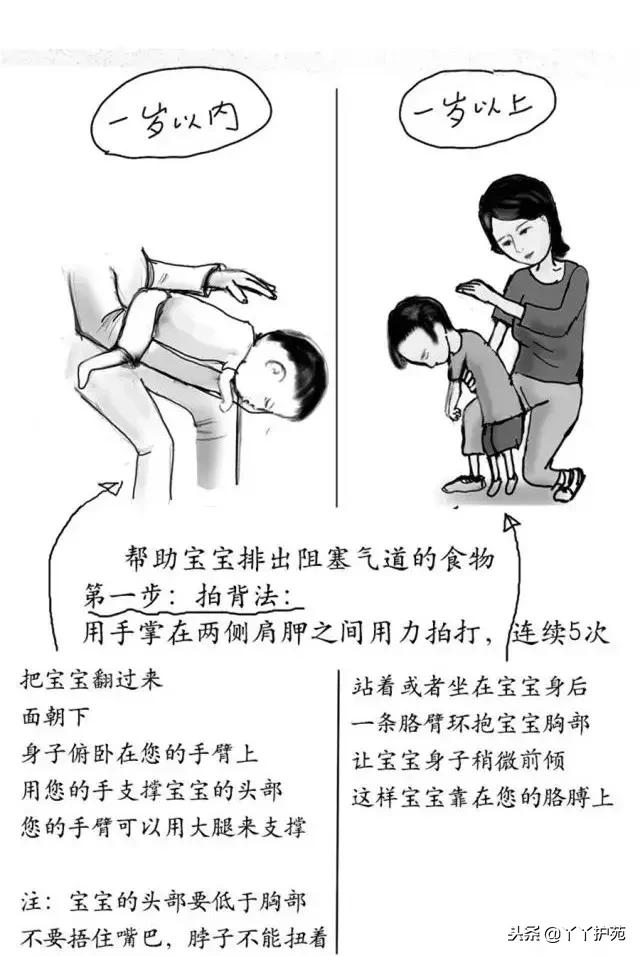 大人气管异物急救法操作过程,婴幼儿气管异物堵塞的急救处理