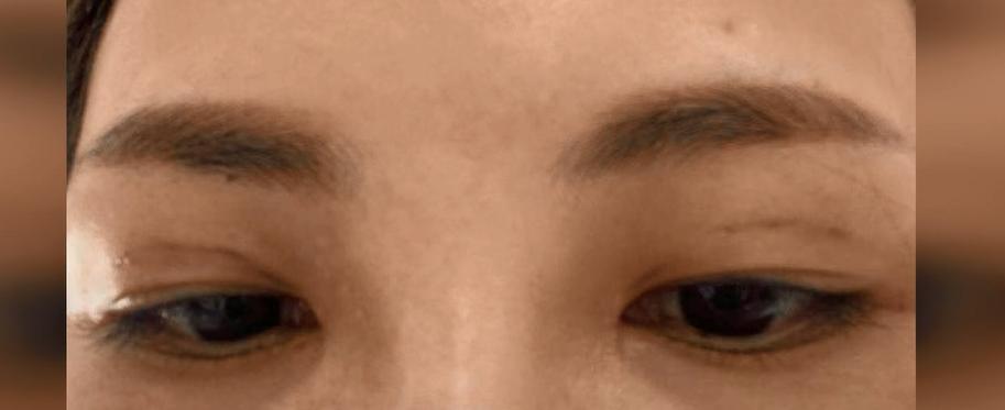 就因为“信任”！镇江一女子花近6000元做手术，却被当成“小白鼠”