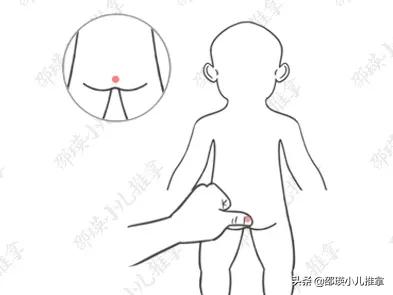 宝宝2岁青蛙肚要多久才能消失,儿童青蛙肚怎么解决