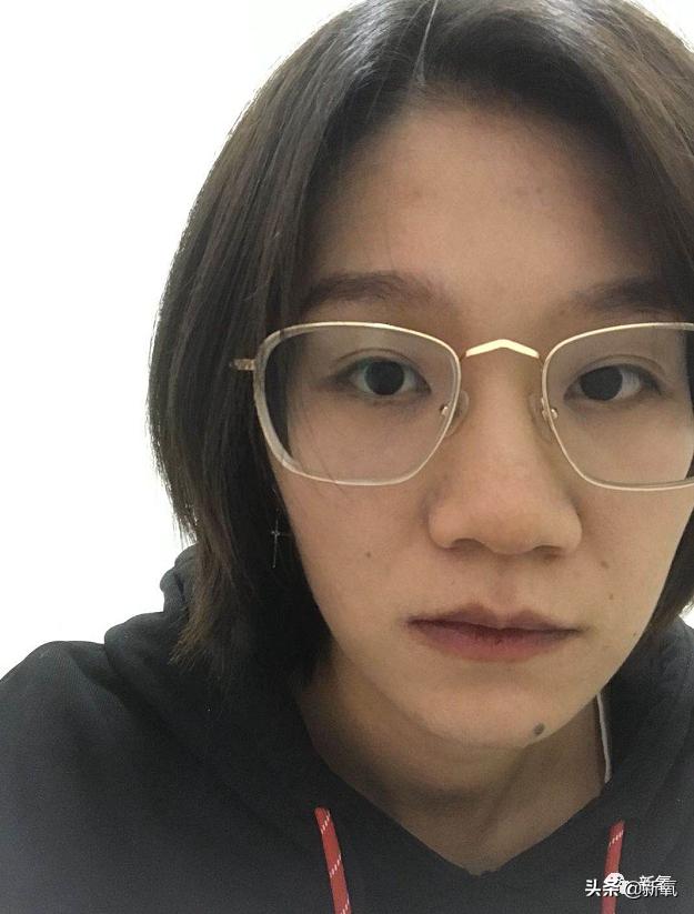 村姑整成鞠婧祎的鼻子变天使,鞠婧祎的鼻子整过吗