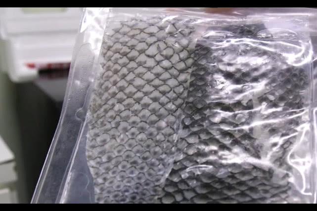 罗非鱼鱼皮治疗烧伤后价值,用罗非鱼鱼皮治疗烧伤