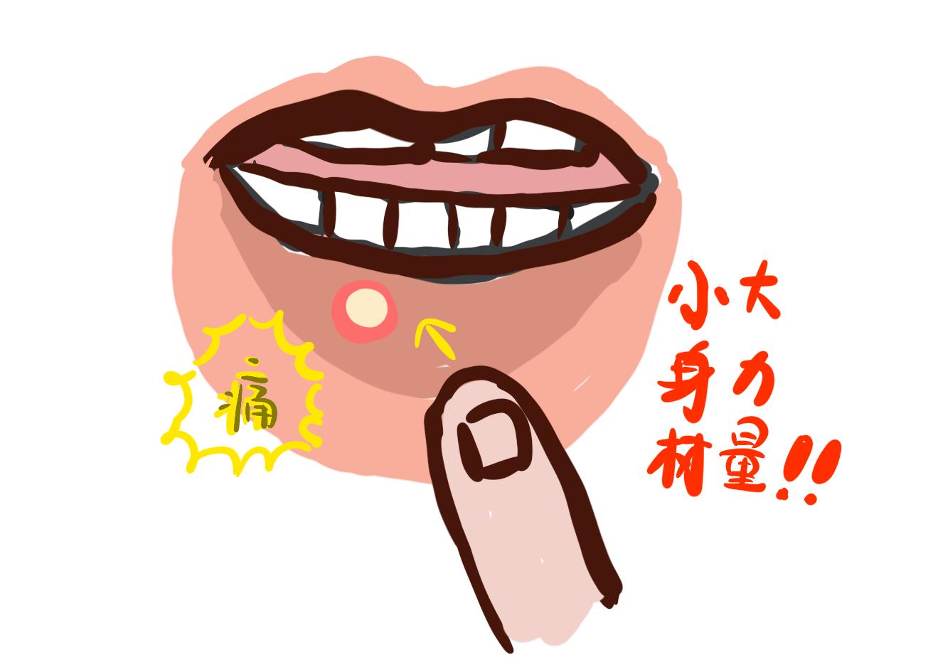 人类做过最勇猛的事，就是在口腔溃疡上撒盐