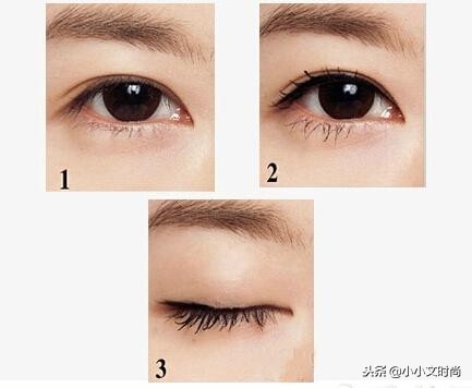 双眼皮后医生不建议用祛疤药,双眼皮手术后医生当场让看效果吗