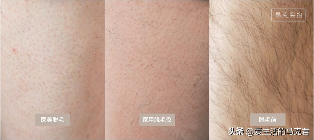 家用脱毛仪哪个牌子脱毛效果最好,家用激光脱毛仪是智商税吗