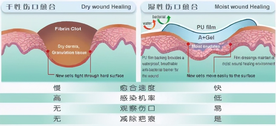 光凝术后不良反应,电疗以后的不良反应