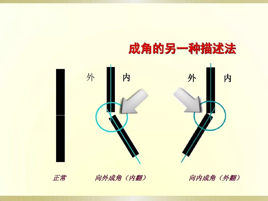 骨科x光片读片技巧,放射科骨科读片教程