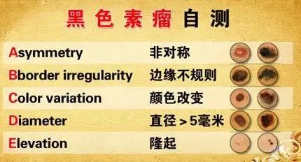 警惕身上长红点,身上长这种斑点竟是癌症前兆