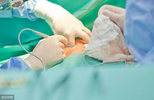 耳朵莫名奇痒会是脑癌吗,耳朵突发疼痛有可能是什么病