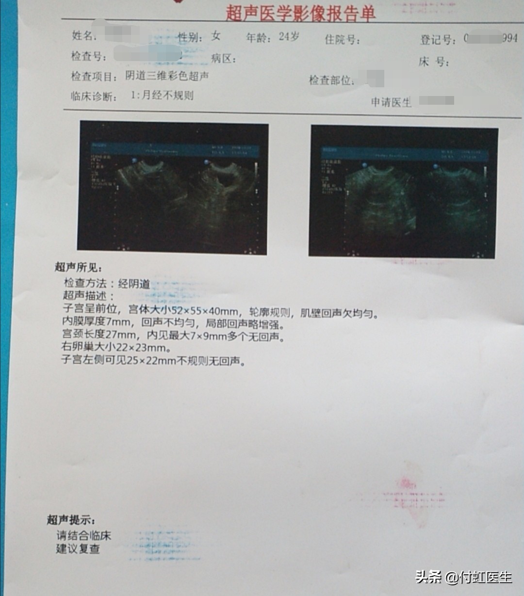 月经来一个月不走，打针吃药都不好使怎么办？